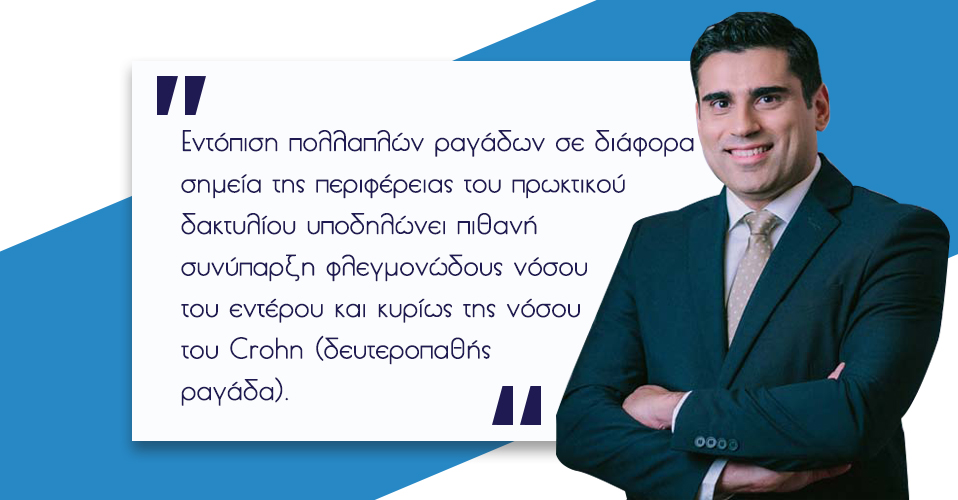 Ραγάδα Δακτυλίου 2 Ραγάδα Δακτυλίου