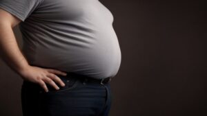 Επιλογή κατάλληλης χειρουργικής επέμβασης για την αντιμετώπιση της παχυσαρκίας 3